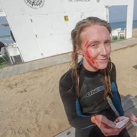 Onlylifeweknow surfer girl getting hurt fail accident blood