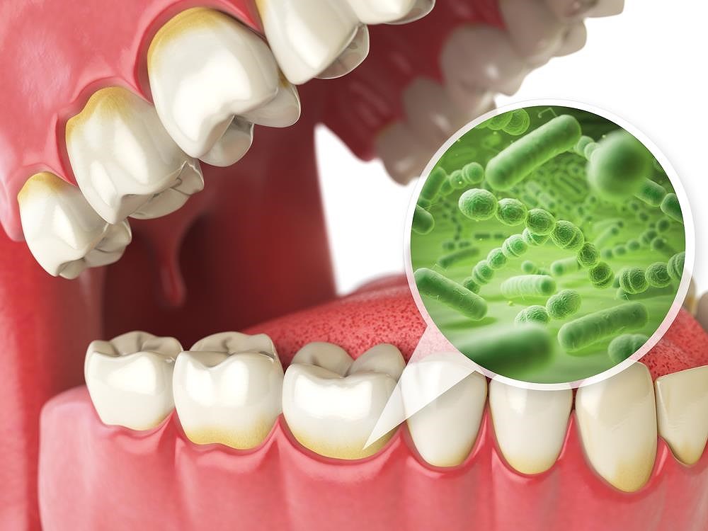 Dental Pro 7 Regrow Gums | samcasey